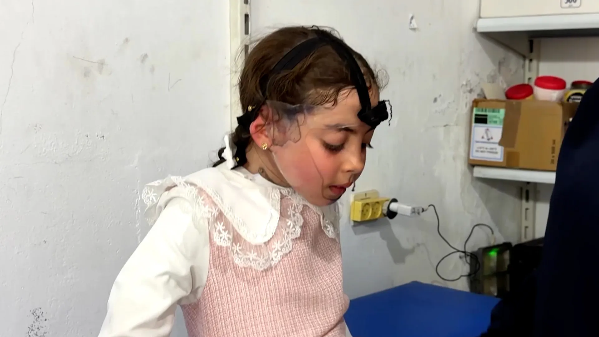 Tratamentul arsuriilor pentru copiii din Gaza amenințat de restricțiile israeliene