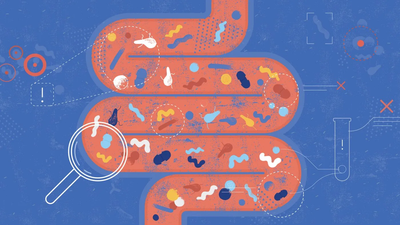 Oamenii de știință caută în microbiom indicii despre creșterea cancerelor colorectale