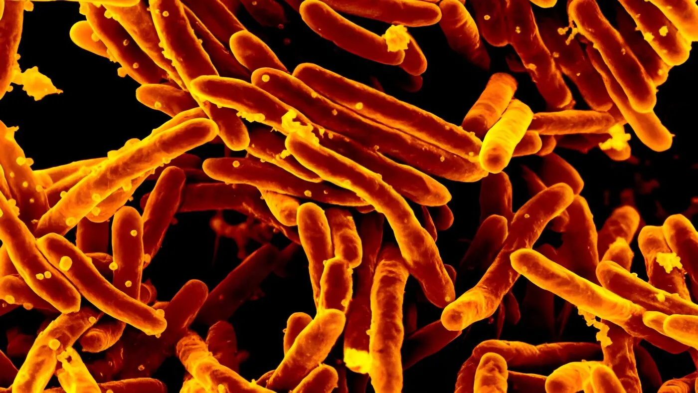 Un vis devenit realitate: un test rapid și precis pentru tuberculoză, fără nevoie de spută