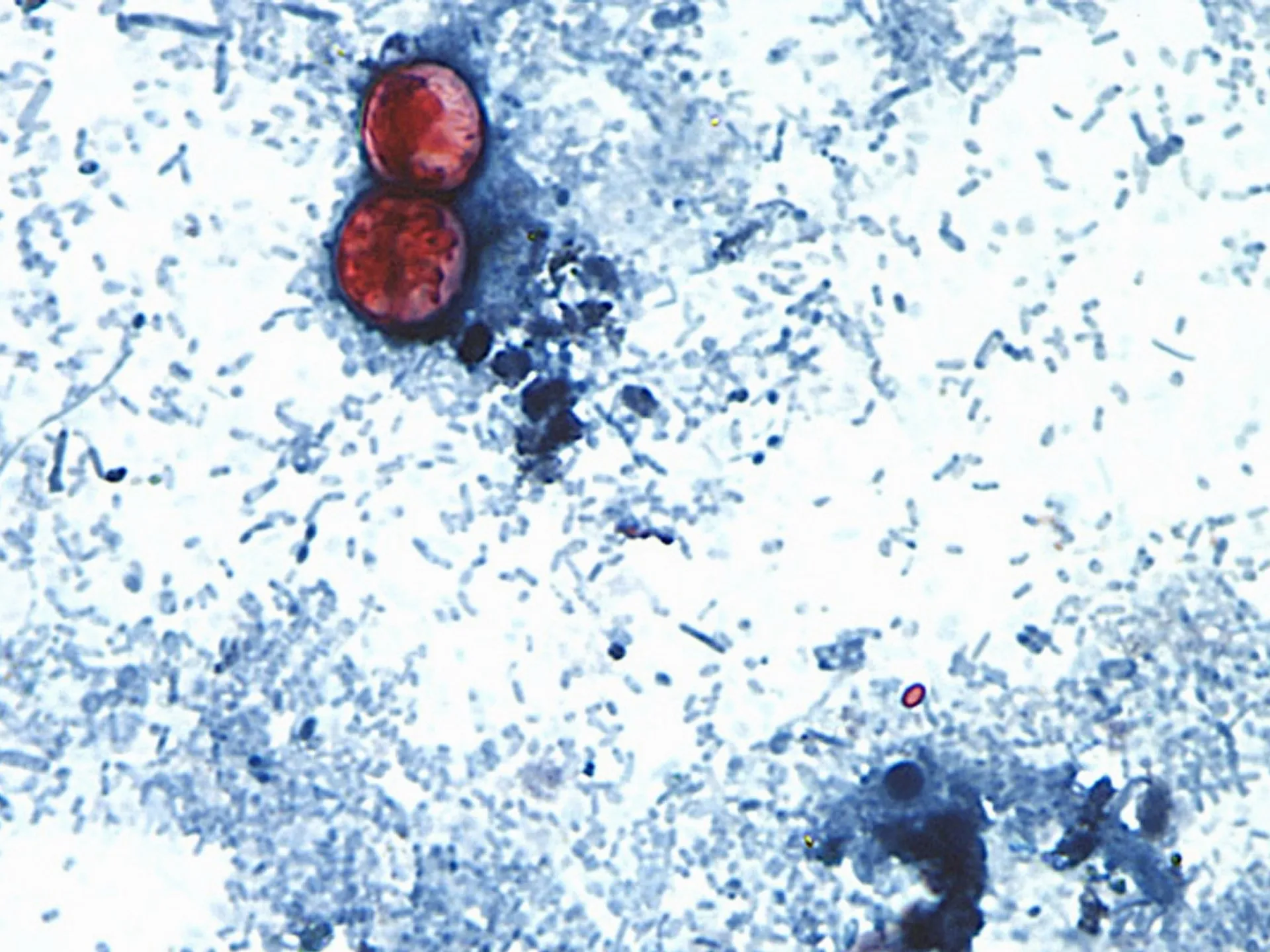 Primele două decese cauzate de epidemia de cyclospora în SUA: autoritățile din Michigan confirmă tragedia