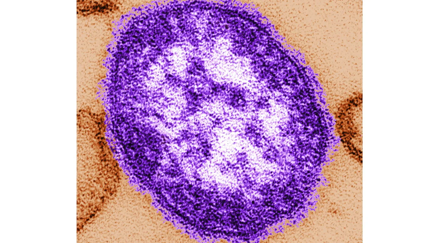 Pennsylvania: o femeie nevaccinată a decedat din complicații ale rujeolei, a treia victimă în mai puțin de trei săptămâni