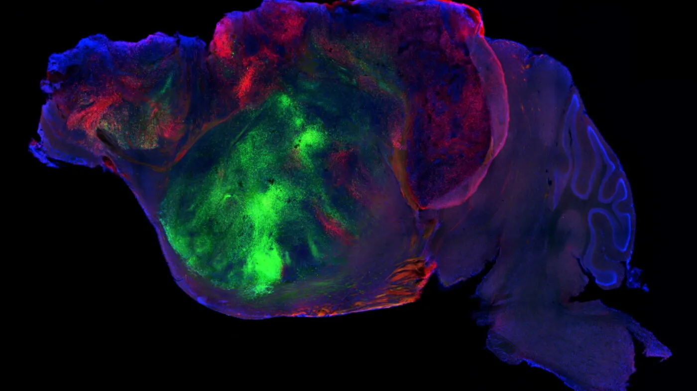 Șoareci cu celule cerebrale umane: o nouă frontieră în cercetarea bolilor neurologice și întrebările etice pe care le ridică